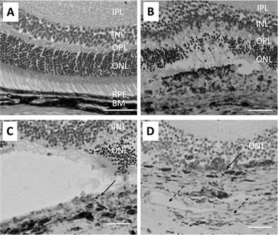 The Role of Retinal Pigment Epithelial Cells in Regulation of Macrophages/Microglial Cells in Retinal Immunobiology